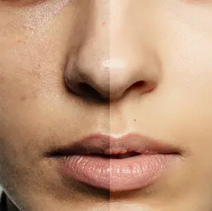 Bridal & Glowing Skin